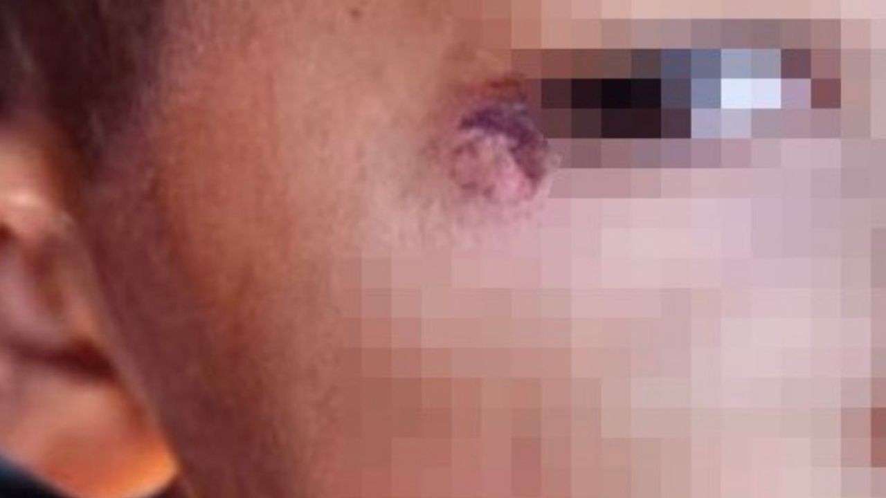 Şanlıurfa'da hademe öğrencinin gözünde sigara söndürdü! İfşa oldu