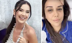 Dilan Polat tedavisini yarım bıraktı: İyileşme umudu kalmadı...