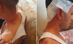 Skandal iddia: MHP'li ismin oğlu ve korumaları tarafından darp edildi, gözaltı bile yapılmadı