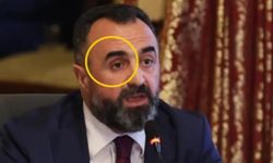 Komisyonda protez gözünü çıkaran gazi 'hainlere af olmaz' dedi