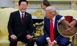 Trump'ın elindeki morluk dikkat çekti