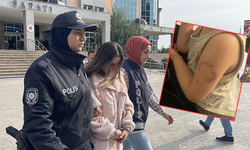 Kreşte 3 yaşındaki çocuğu ısırdığı iddia edilen bakıcı tutuklandı