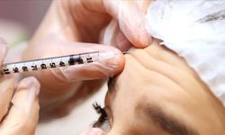 Dermatoloji Derneği uyardı… 15 yaşa kadar düştü!