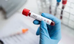 AIDS'e karşı tedavi umudu: HIV virüsünü yüzde 98 etkisiz kılan antikor keşfedildi