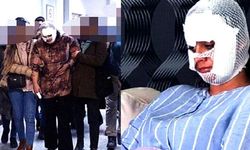 Eşinin yüzünü paramparça eden caniye ‘haksız tahrik indirimi’ uygulandı… 5 yıl 3 ay ceza verildi!