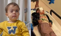 Torpil, 2 yaşındaki Alpaslan’ın gözünü kaybetmesine sebep oldu!