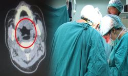 Midesinden çıkan şoke etti: Tam yarım kilo!