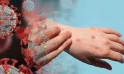 Ölümcül virüs hızla yayılıyor! Dünya Sağlık Örgütü'nden uyarı