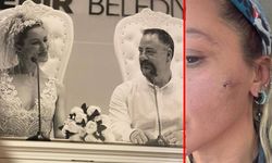 Ünlü oyuncu fotoğraflar paylaşıp ‘Kocam tarafından darp edildim’ dedi