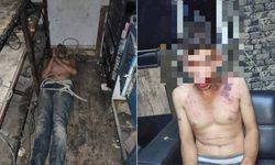 Üç gün boyunca işkenceye maruz kaldı… Dişleri kırıldı, hamam böceği yedirildi… İşkenceciler sadece 7 yıl ceza aldı!