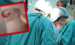 İş kazası sonrasında kulağını 5 ay ayağında taşıdı