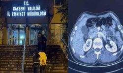 Operasyonda yakalanan İranlı şüphelilerin midelerinden uyuşturucu çıktı!