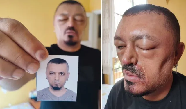 301 liraya aldığı şampuan kör ediyordu!