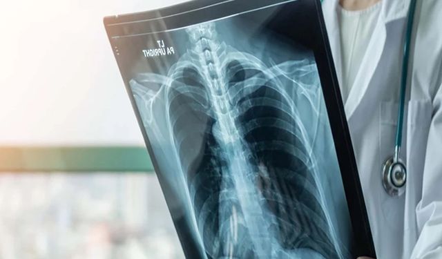 Prof. Dr. Alper Şener'den 'süperenfeksiyon' uyarısı