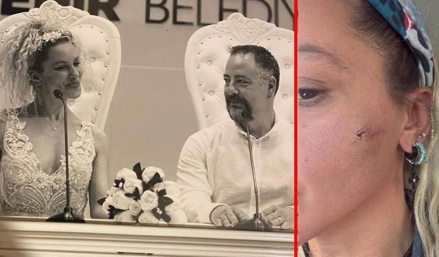 Ünlü oyuncu fotoğraflar paylaşıp ‘Kocam tarafından darp edildim’ dedi