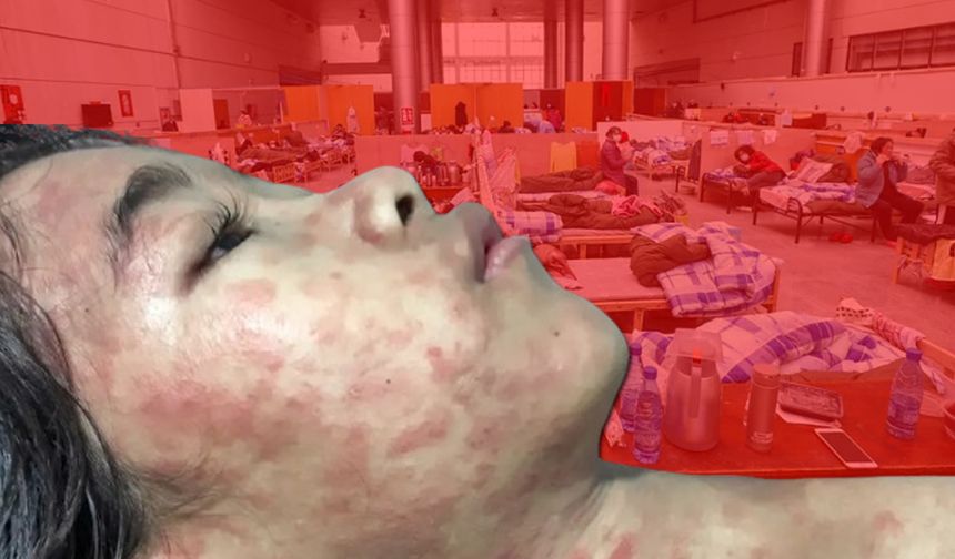 Vaka sayıları patladı! Acil durum ilan edildi